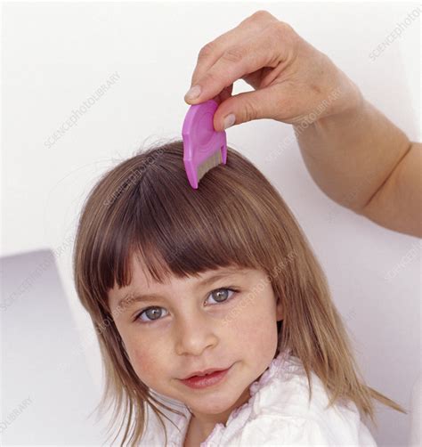 Removing Head Lice Stock Image M8330177 Science Photo Library