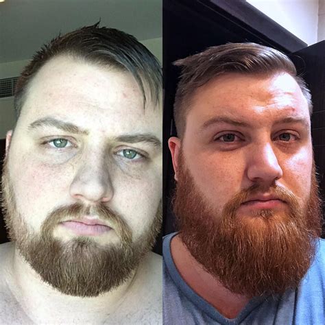 Patchy Beard Growth Progress Beard On Brother