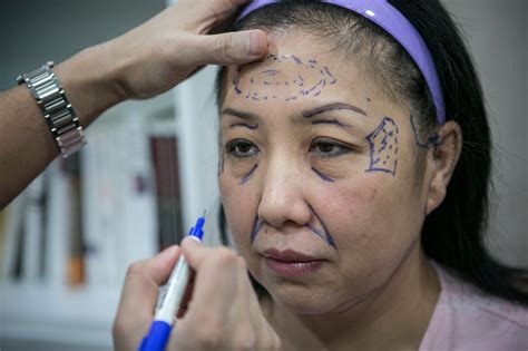 Plastic Surgery Tourism Brings Chinese To South Korea The New York Times