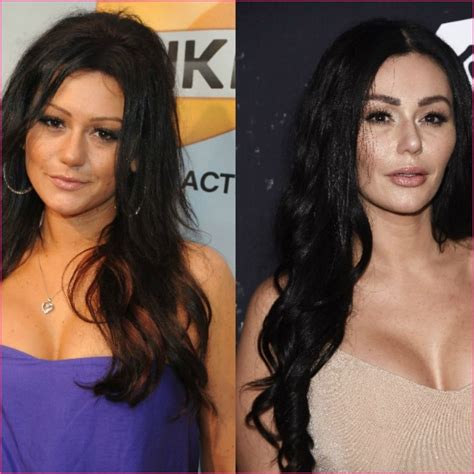 New And Improved The Top 15 Celebrity Plastic Surgeries For The Win