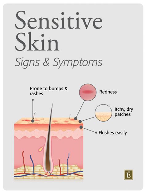 Sensitive Skin Care The Signs And Symptoms Eminence Organic Skin Care