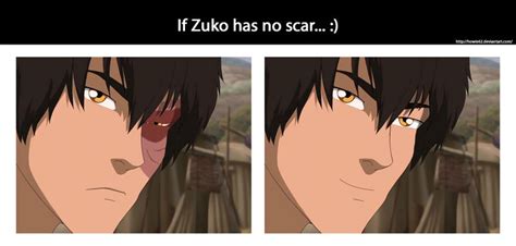 If Zuko Has No Scar By Howie62 On Deviantart