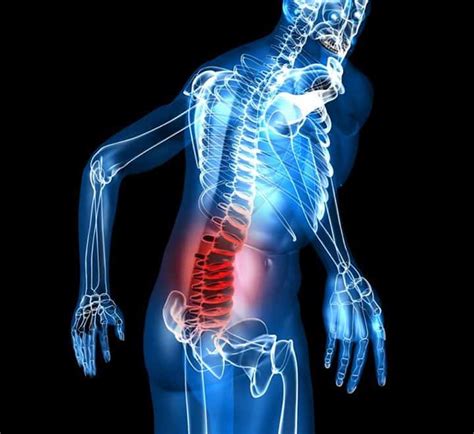 Back pain and posture Mat Boulé Osteopath Posturologist Educator