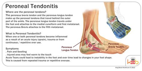 Ginasdesignerworks Ankle Pain Arthritis Symptoms