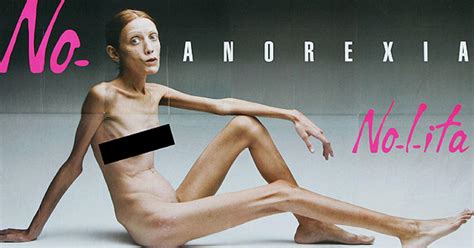 Isabelle Caro Photos Nude Anorexia Pictures Shocked World CBS News