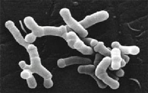 Difference Between Lactobacillus And Bifidobacterium Compare The