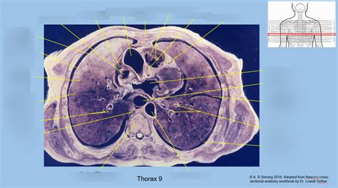 Thorax Cross Section 9 Diagram Quizlet