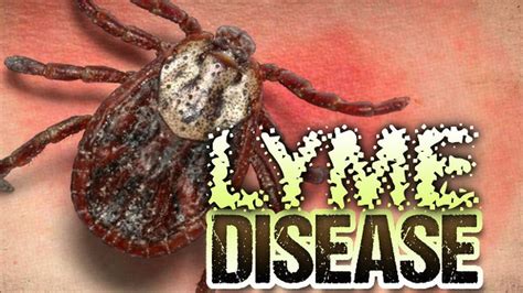 Lyme Disease Cases In Ohio Up 33 In 2017