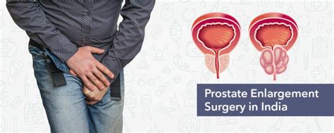 Prostate Enlargement Treatment In India