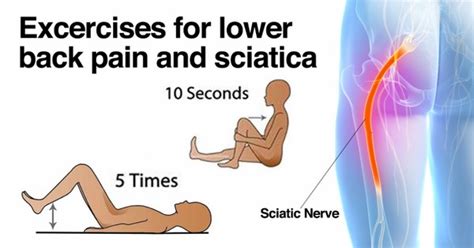 How To Cure Sciatica With 5 Simple Exercises