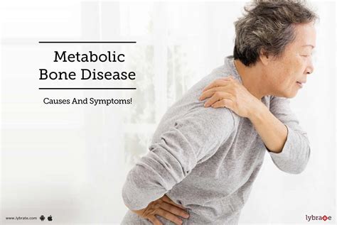 Metabolic Bone Disease Causes And Symptoms By Dr Radhakrishnan