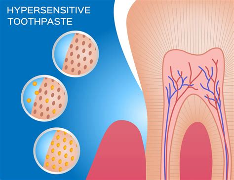 the top tooth sensitivity solutions west palm beach dentist