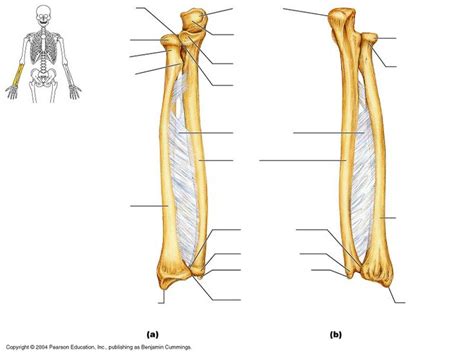 unlabeled radius & ulna | Radius and ulna, Anatomy bones, Bones anatomy