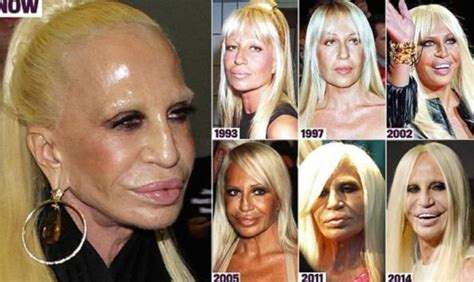 Worst Celebrities Plastic Surgeries Fails That Would Make You Think Twice Before Any