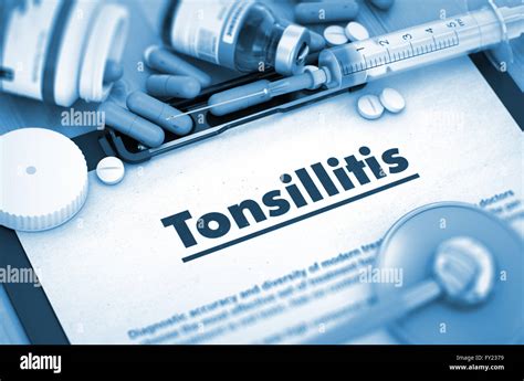 Tonsillitis Diagnosis Medical Concept Stock Photo Alamy