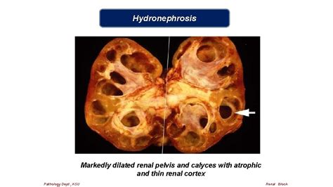 Renal Block Pathology Practical I Ii Prepared By