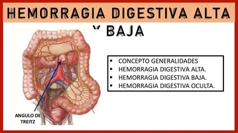 Hemorragia Digestiva Alta Y Baja Udocz