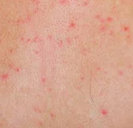 Is the skin of your leg red, itchy and inflamed? Small red spots on skin