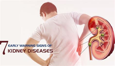 7 Early Warning Signs And Symptoms Of Kidney Disease