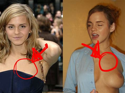 Emma Watson The Fappening Topless Thefappening Library