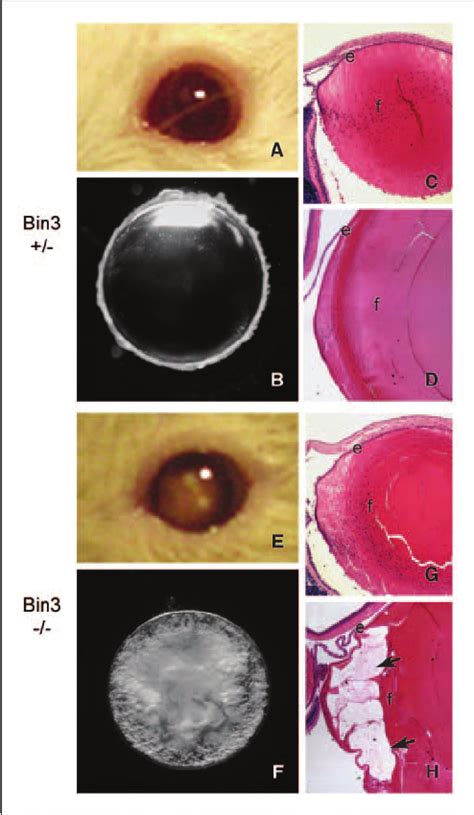 Cataract Formation In Bin3 Nullizygous Mice Phenotype Gross
