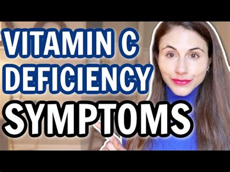 Vitamin C Deficiency Symptoms Dr Dray Youtube