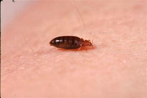Scabies Vs Bed Bugs