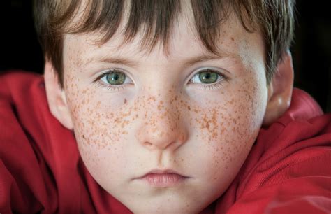 What Causes Fabulous Freckles Kids Discover