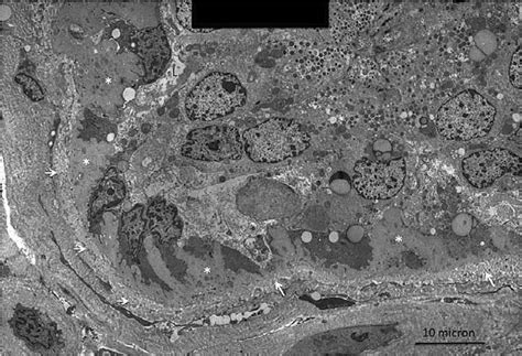 Electron Micrograph Of The Secretory Portion Of An Eccrine Sweat Gland