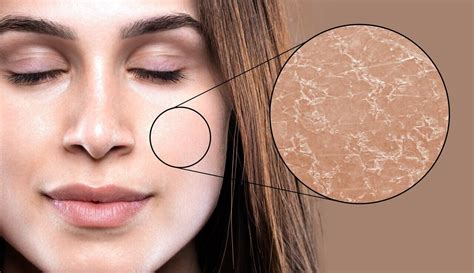 How To Tell If You Have Dry Skin Beautiful You Review News