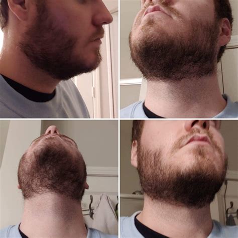first time beard grower 5 weeks in how does my neck line look used the double chin method and