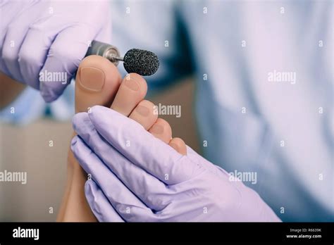 Chiropodist Treating A Patients Foot Pedicure Treatment Stock Photo