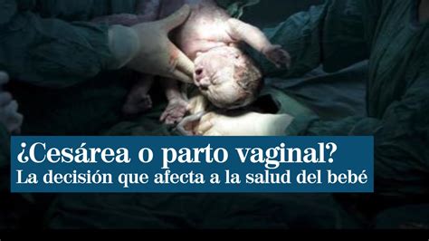 Nacer Por Cesárea O Parto Vaginal Condiciona La Salud De Tu Bebé Youtube