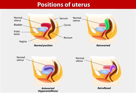 Bimanual Examination Of The Uterus Includes Yaminfut