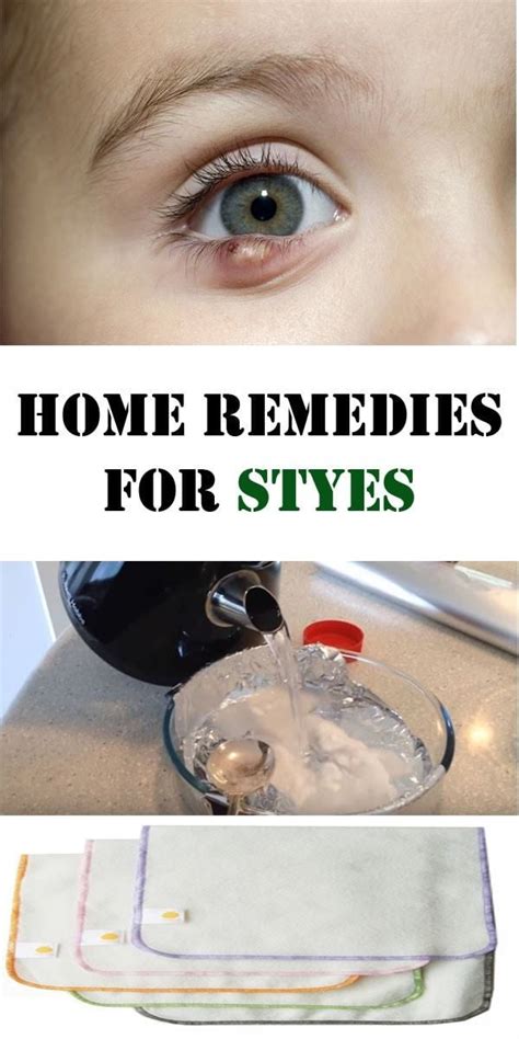 Home Remedies For Styes Skinnyms Severe Acne Remedies Remedies Styes