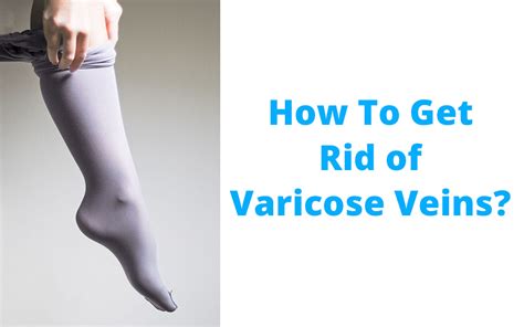 Easy Relief From Varicose Veins Healing Hands Clinic