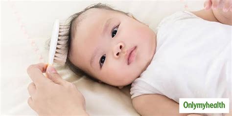 Dry Scalp In Babies Symptoms Causes And Ways To Treat At Home