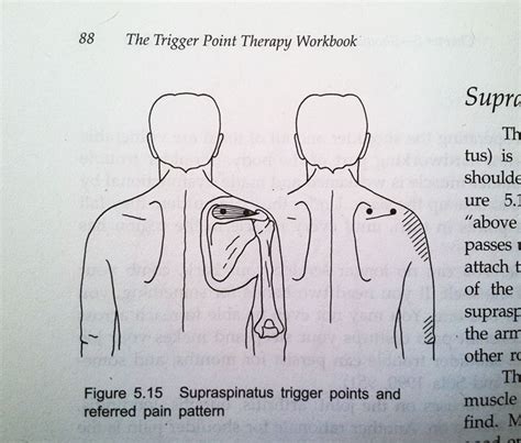 Trigger Point Therapy Workbook Review