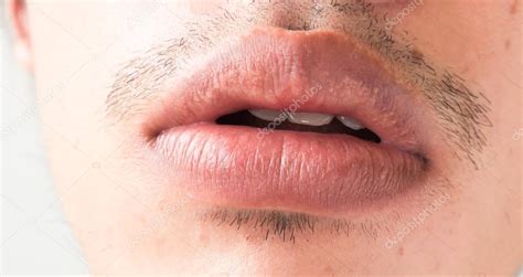 Closeup Of Lips Man Problem Health Care Herpes Simplex Stock Photo By