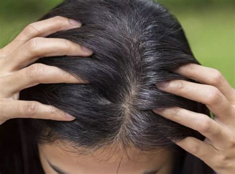 Sores On Scalp Causes With Hair Loss And Treatments American Celiac