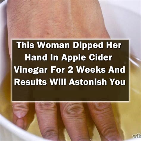She Dipped Her Hand In Apple Cider Vinegar For 2 Weeks When You Read
