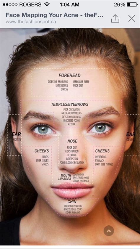 What Are Your Face Breakouts Telling You Face Mapping On What Pimples