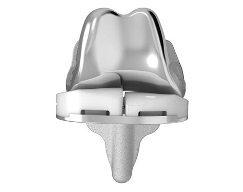 Conformis Announces Study Comparing Customized Total Knee Replacement