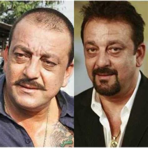 Sanjay Dutt To Salman Khan These 5 Bollywood Actors Underwent Hair Transplant Their Before