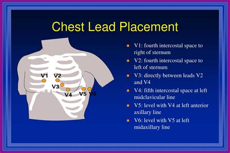 Ppt Introduction To 12 Lead Ecgs Powerpoint Presentation Free