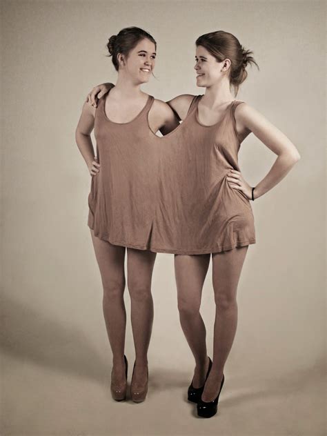 Togetherness Fetish Siamese Twins Photoshoot