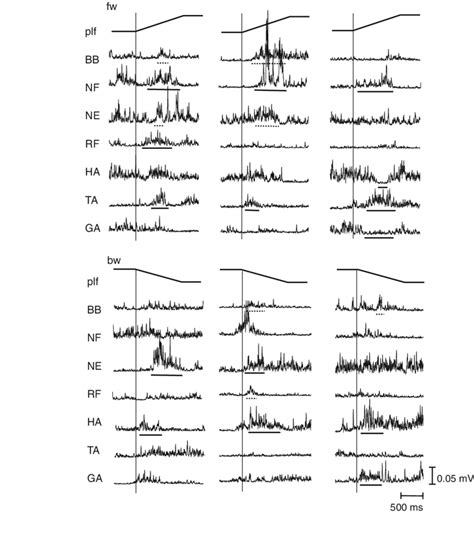 Electromyography Examples Of One Infant Aged 8 Months During Six