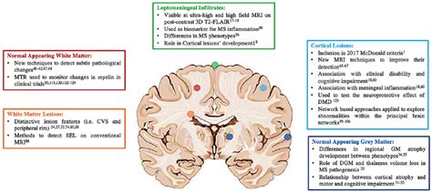 Advances In Brain Imaging In Multiple Sclerosis In Different Brain