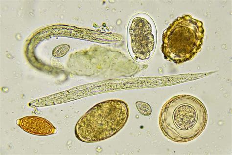 The 10 Most Common Parasitic Infections Facty Health