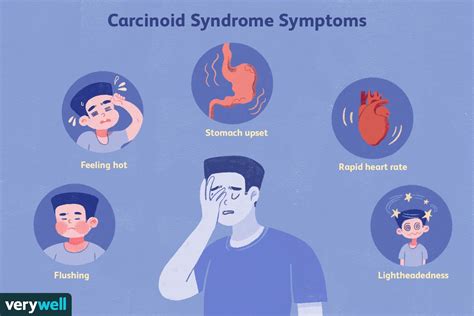 carcinoid syndrome symptoms causes diagnosis and treatment